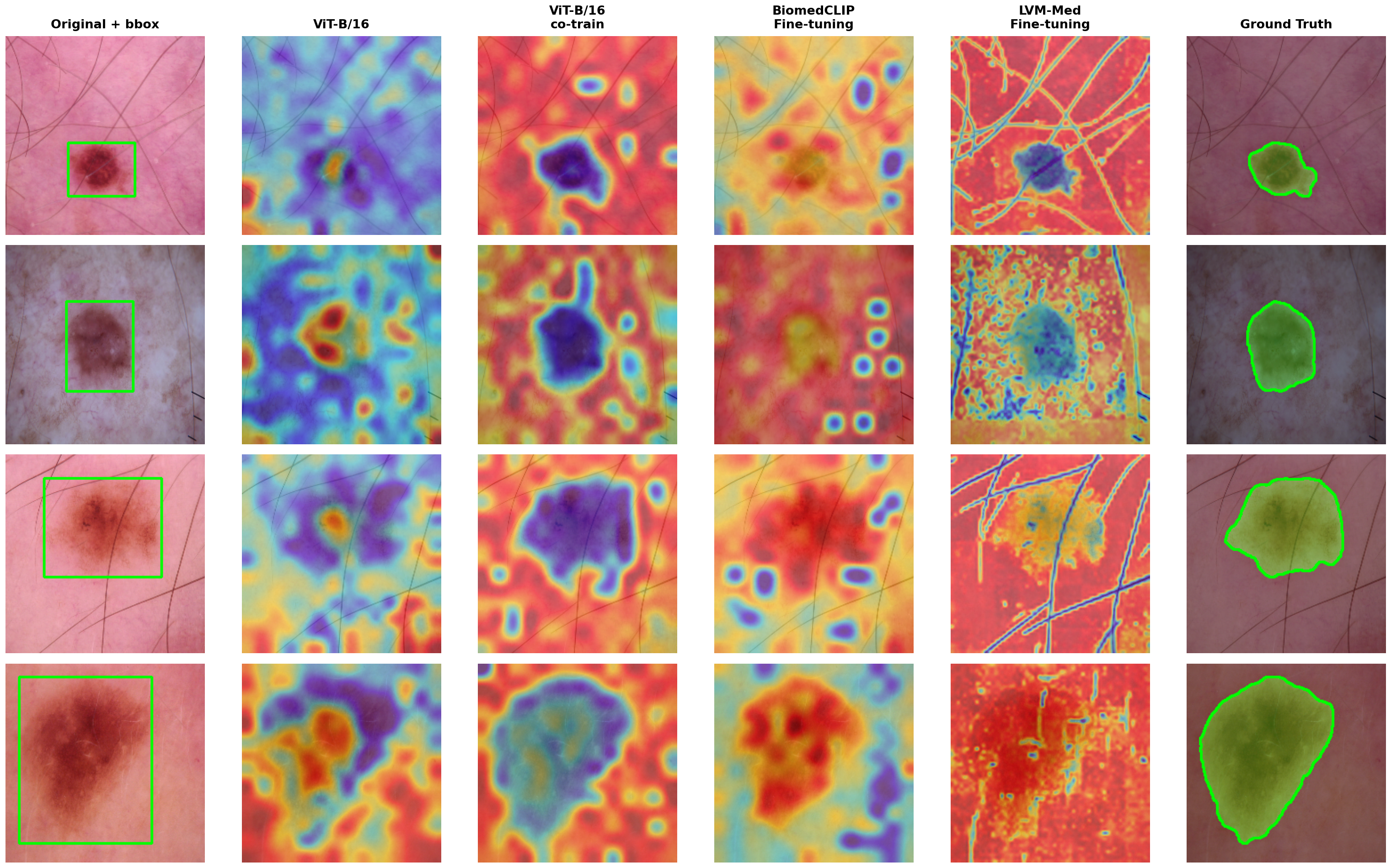Patch-score heatmaps across evaluated methods on ISIC/HAM10000.